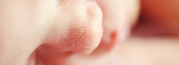 【成長と共に解消する】乳児の赤ちゃんが湿疹で首回りがジュクジュクなのは、アレルギーかも！？